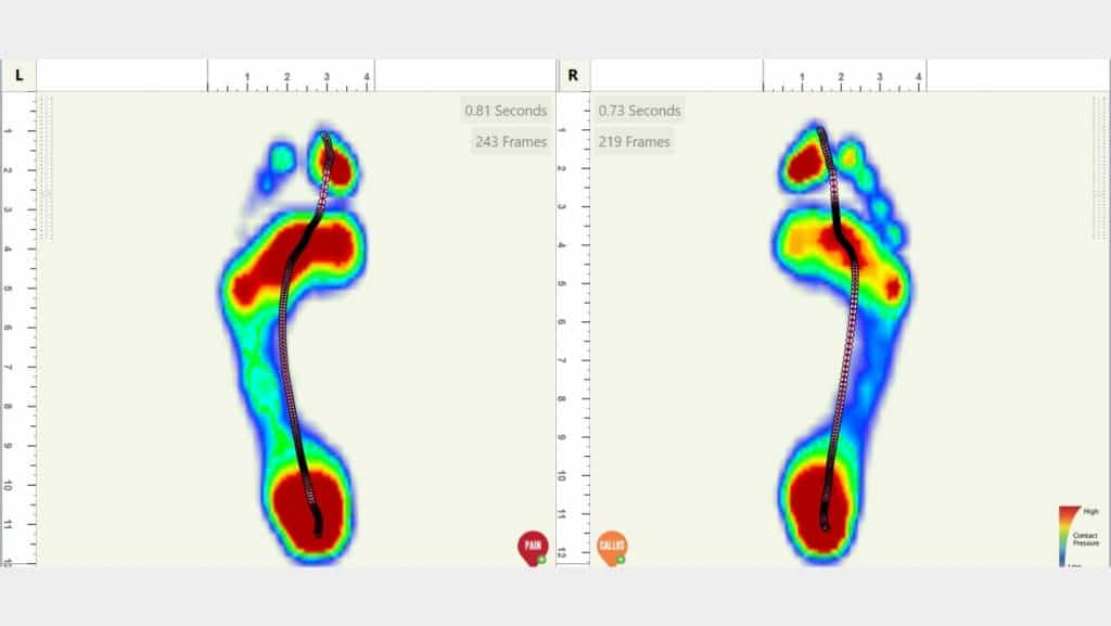 Foot Gait Scan