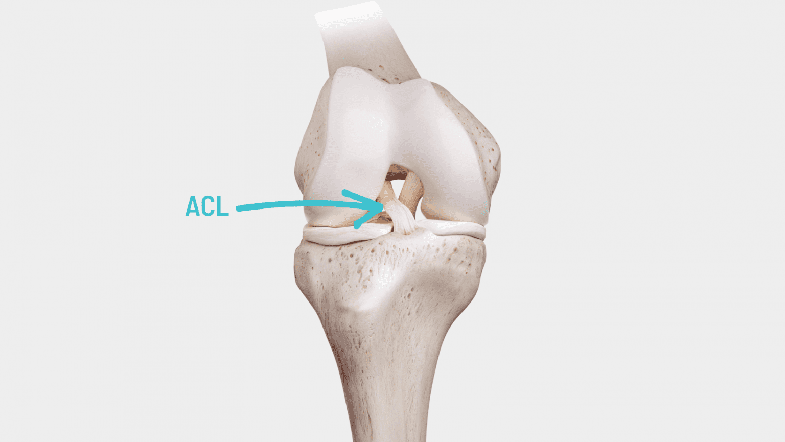 acl-rupture-surgery-or-acl-rupture-with-surgery