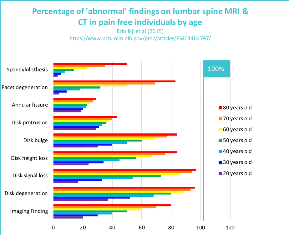 MRI Back pain graph