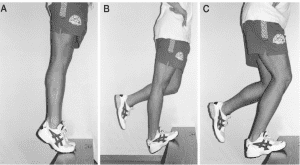 Alfredson Protocol | Achilles Tendonitis