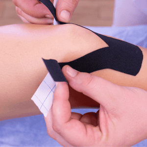 Fat Pad Impingement taping | Flawless Physio