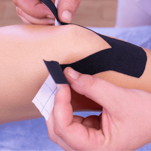 Knee Fat Pad Impingement - Symptoms, Causes and Treatment