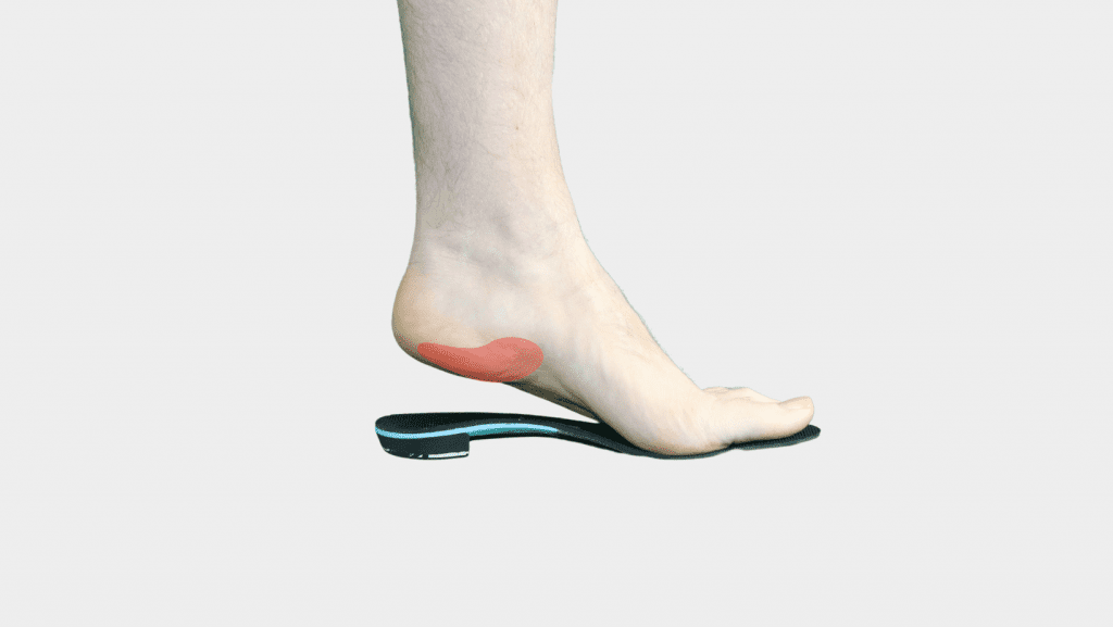 Special insoles for plantar on sale fasciitis