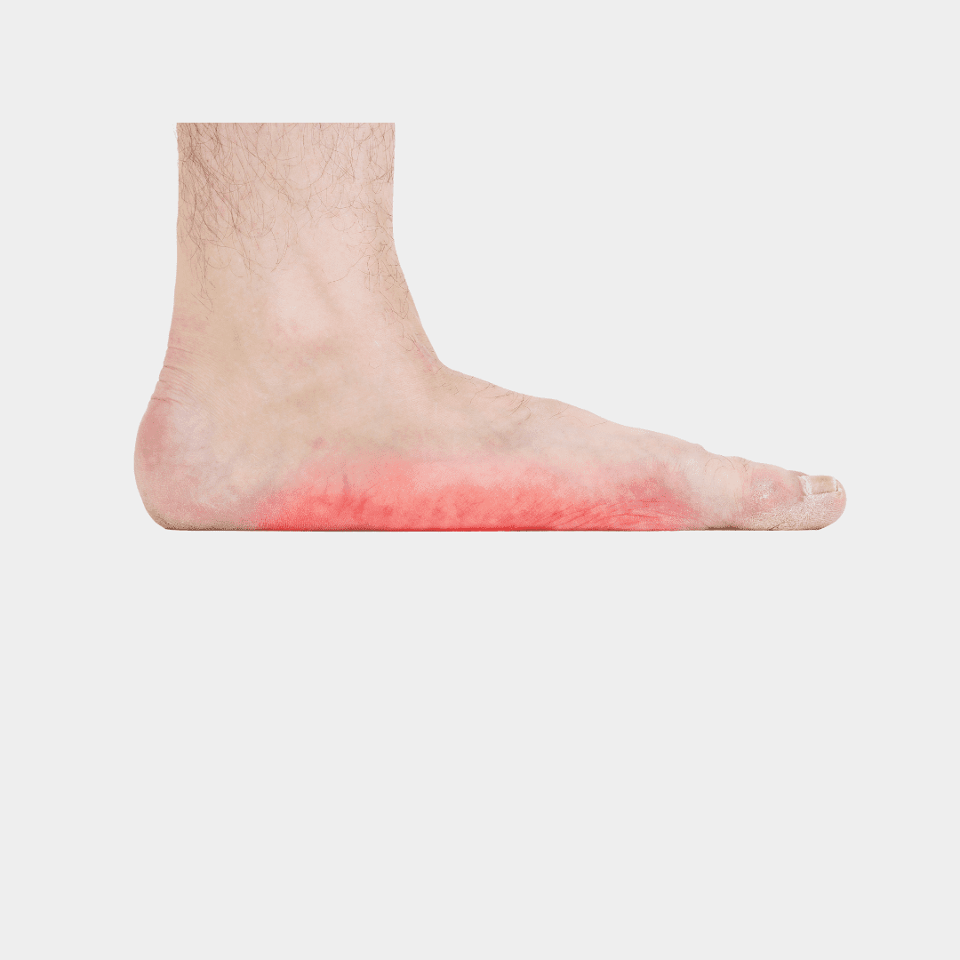 flat feet insoles amazon