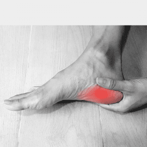 Plantar Fasciitis