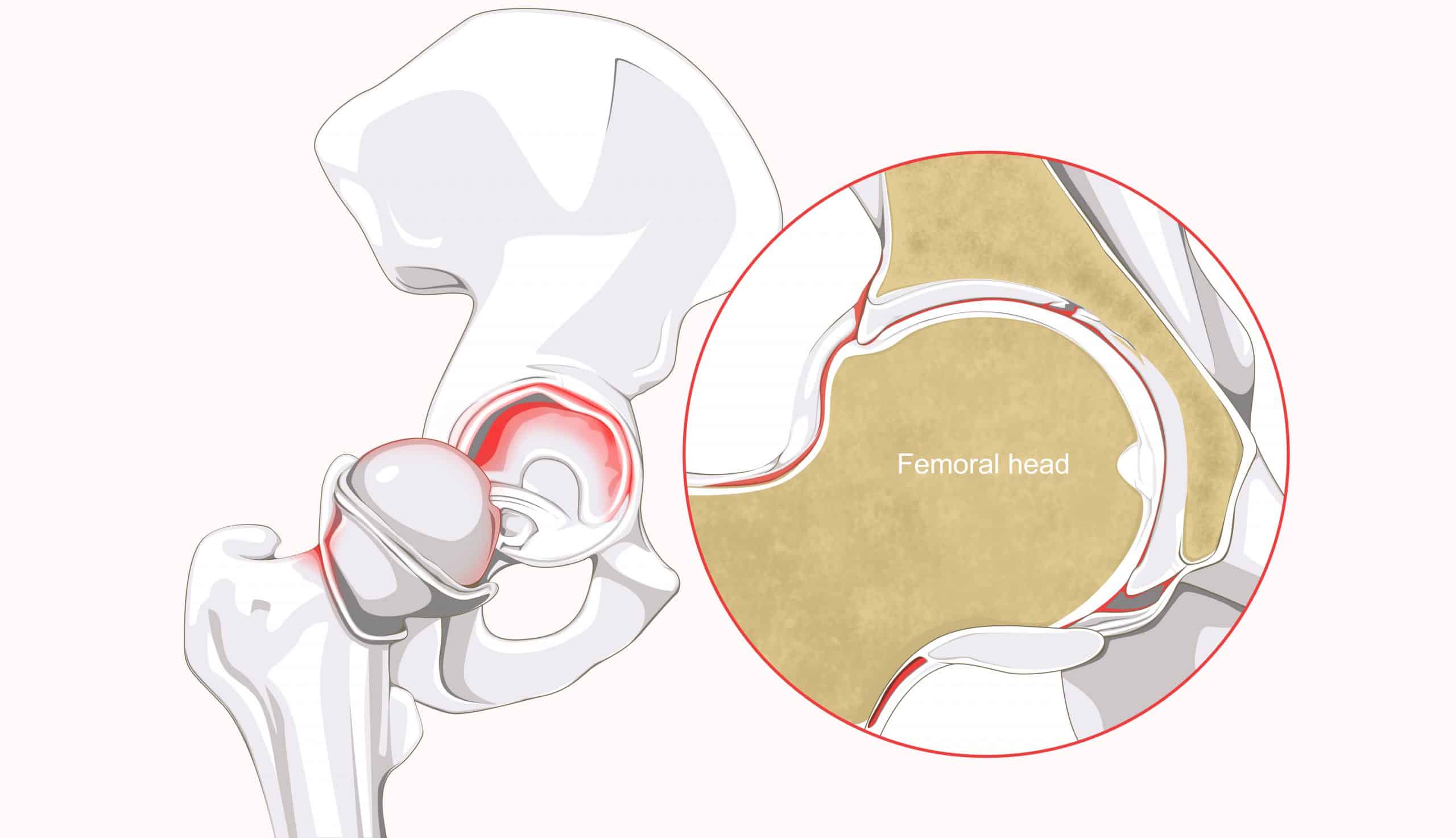 running hip pain