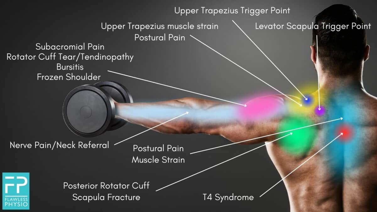 Shoulder on sale injury diagnosis