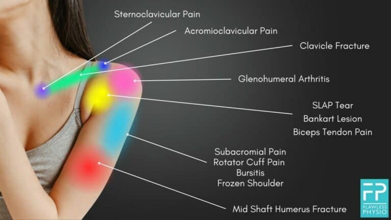 shoulder-pain-diagnosis-chart-shoulder-pain-location-chart