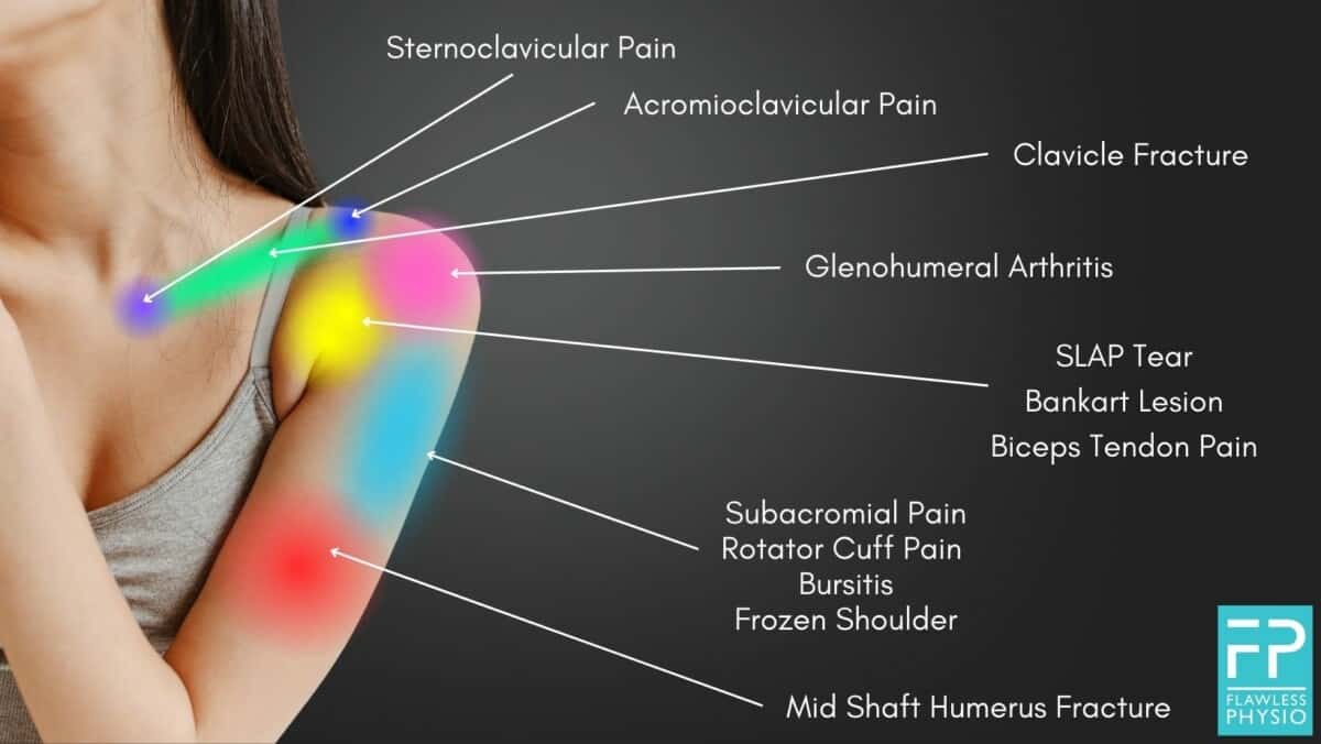 Shoulder Injury Diagram