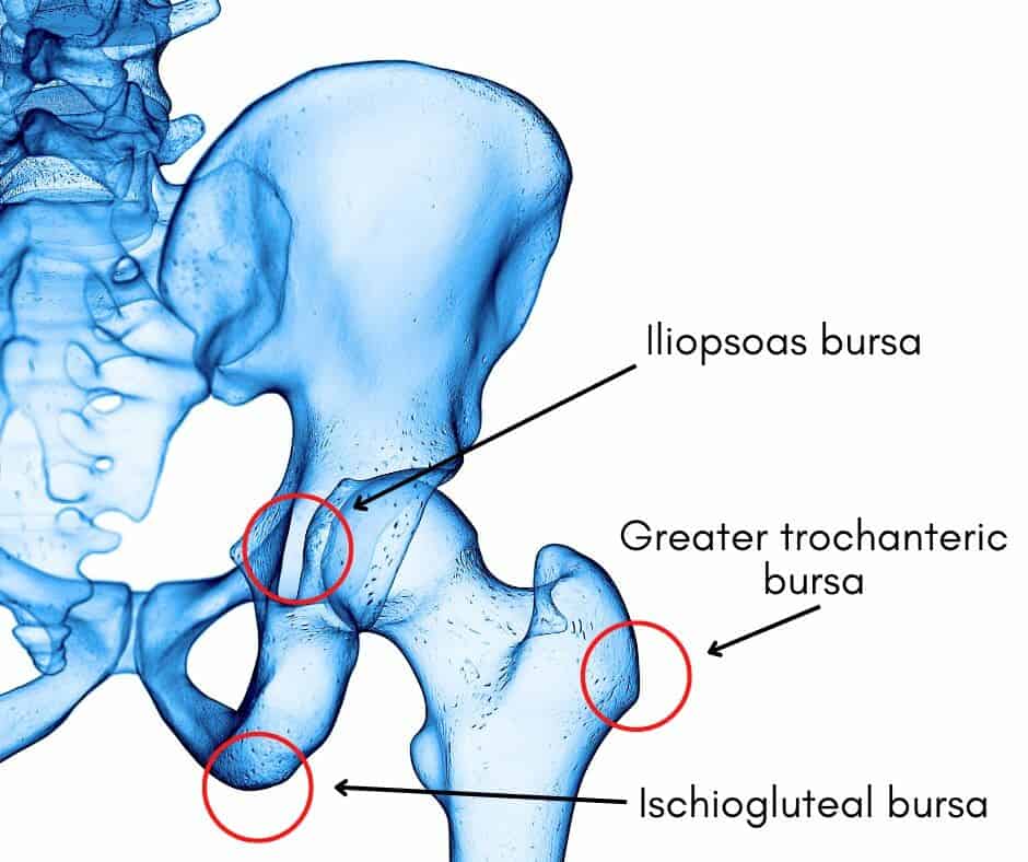 Hip bursitis location diagram