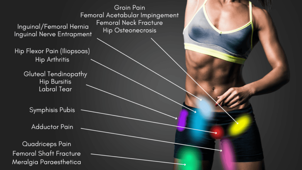 Hip Pain Location Diagram