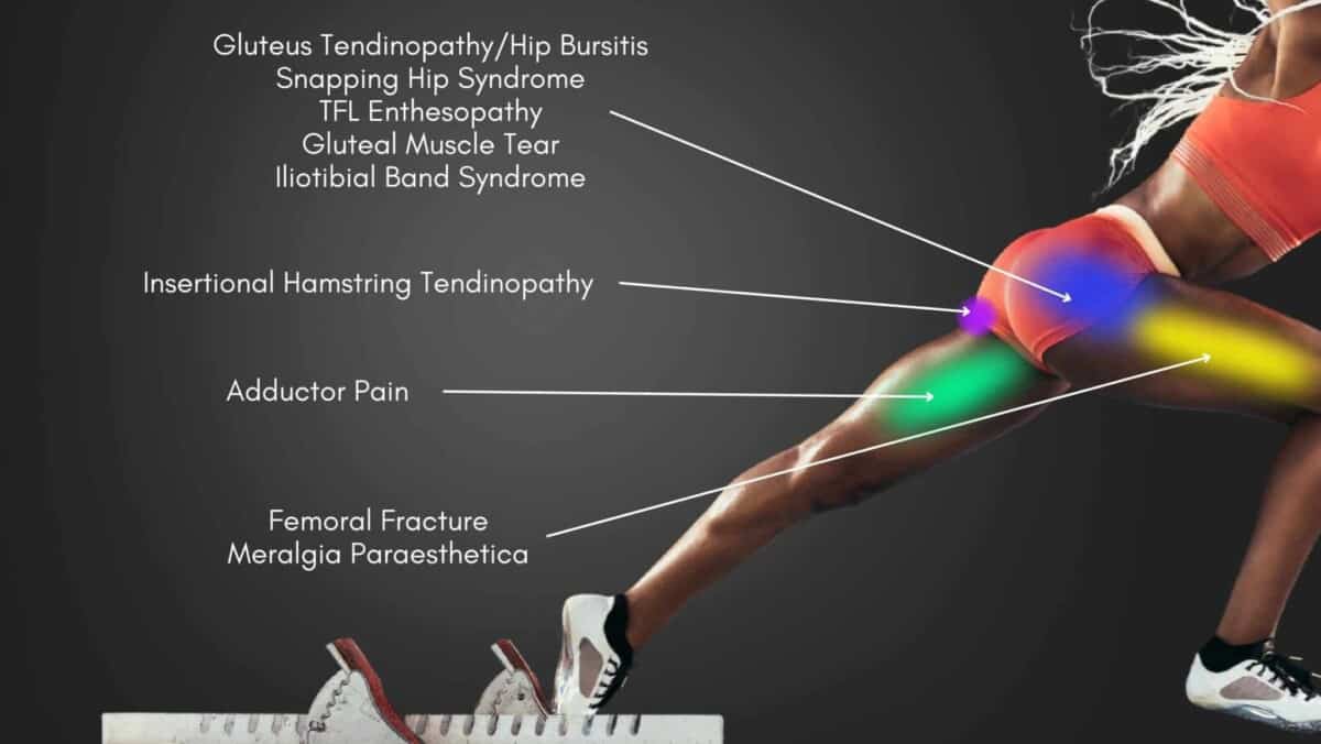 Hip Pain Location Diagram | Hip Pain Chart