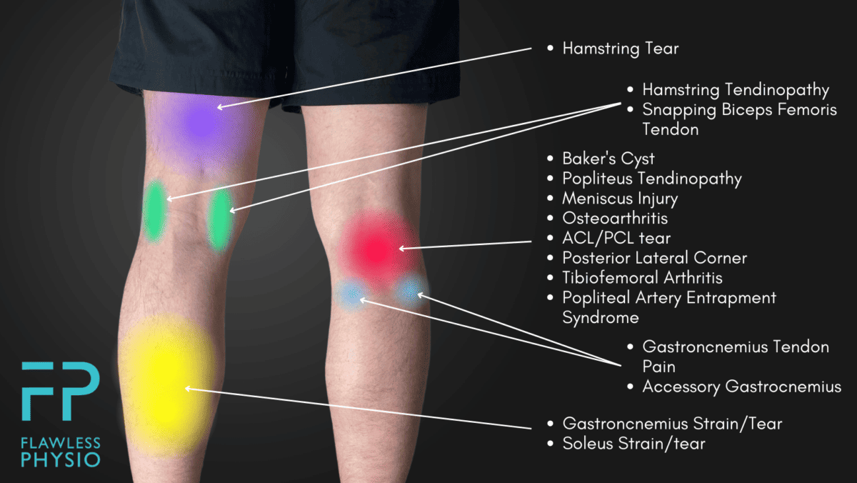 Knee Pain Location Chart - Find the Cause of Your Knee Pain