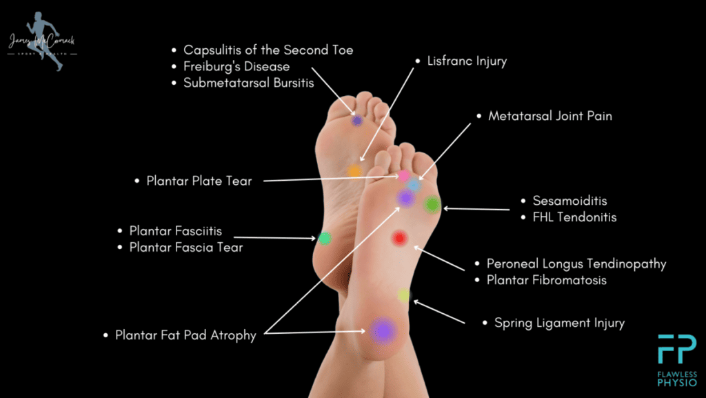 Bottom of Foot Pain Chart