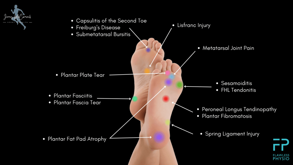 Foot Pain Chart - Find the Cause of Foot Pain with our Diagram