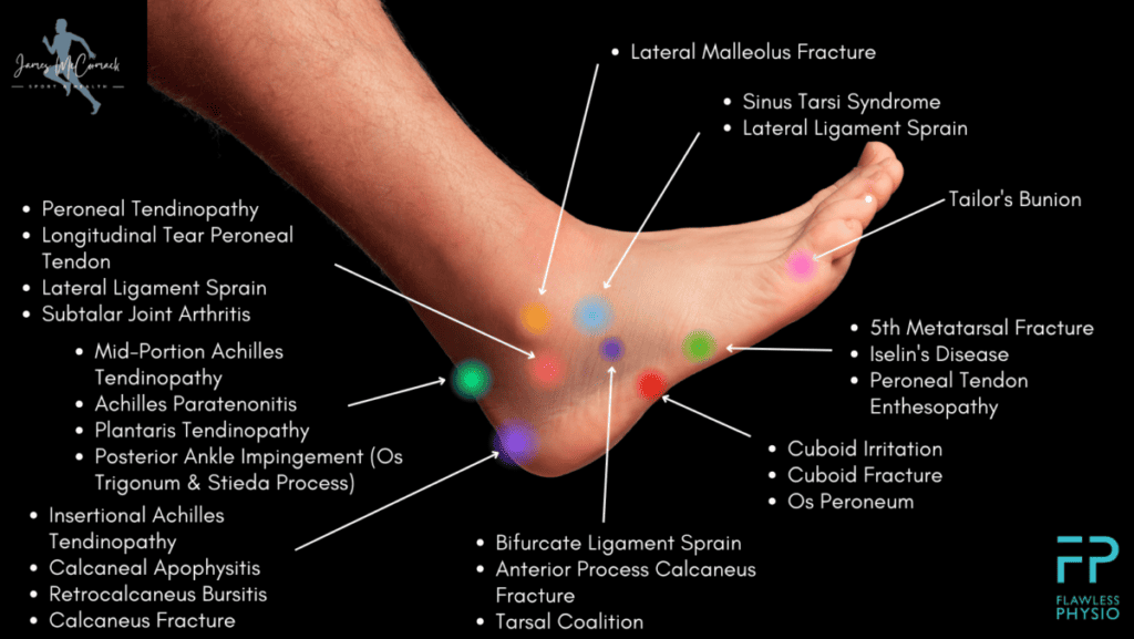 Foot Pain Chart - Find the Cause of Foot Pain with our Diagram