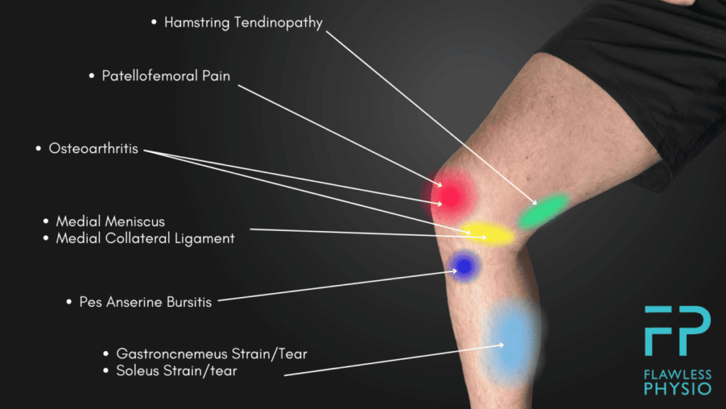 Inner Knee Pain Location Chart