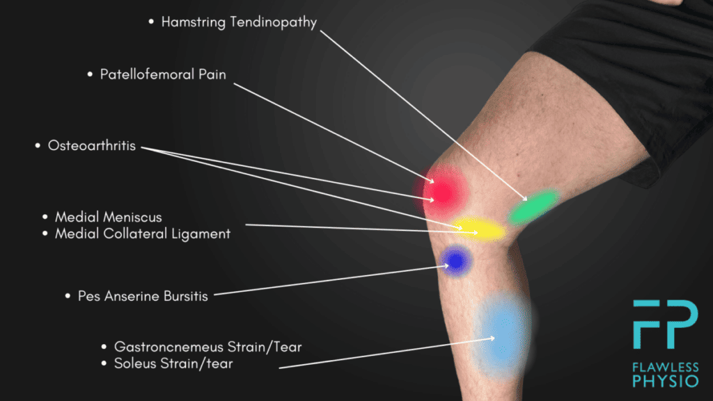 Knee Pain Location Chart Find The Cause Of Your Knee Pain