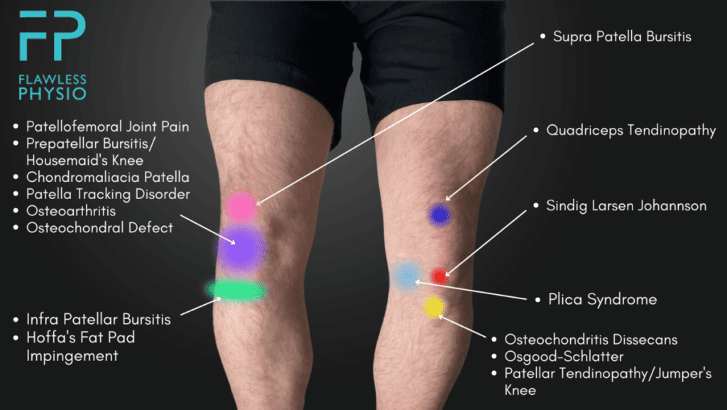 Where is the clearance patella located