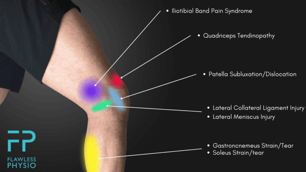 Outer Knee Pain Location Chart