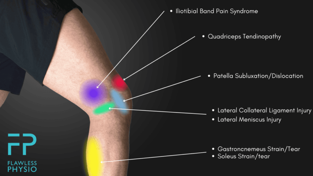 Knee Pain Location Chart Find The Cause Of Your Knee Pain