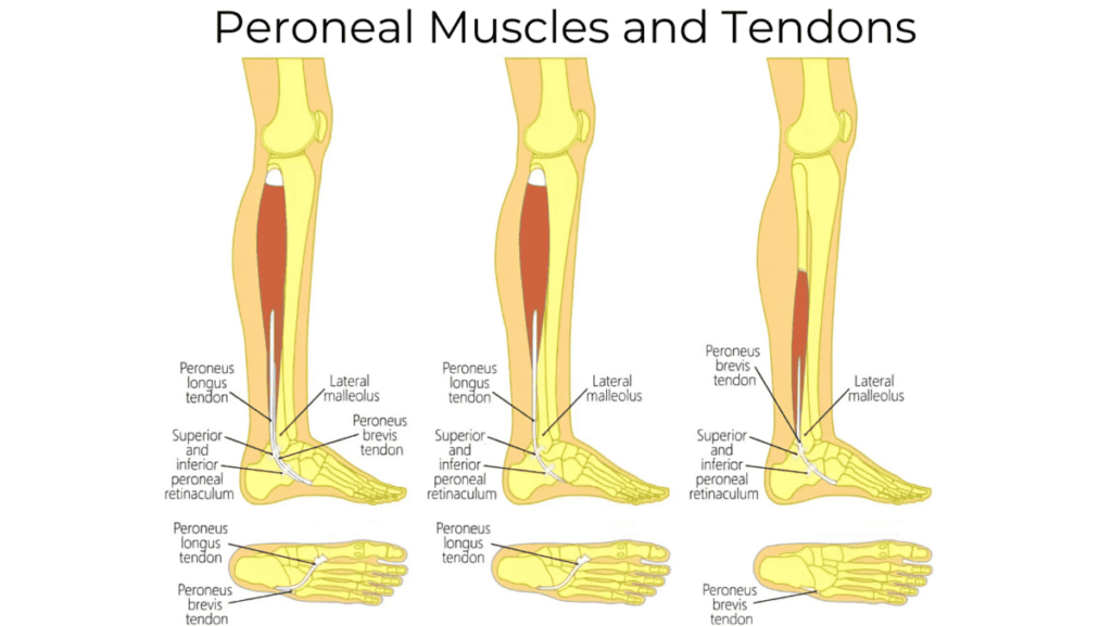 Diagram showing the peroneal tendons and muscles attaching to the bones of the foot, illustrating their role in foot and ankle stability.